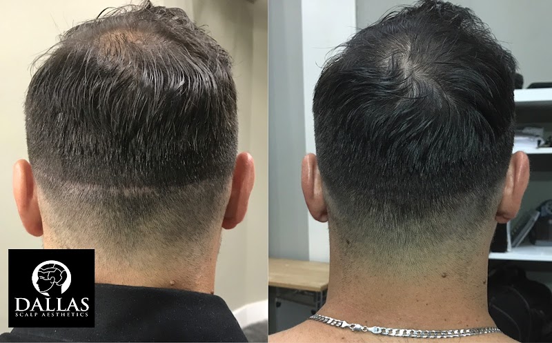 Dallas Scalp Associates